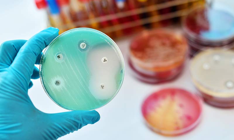 Antibiyotik Direncine Karşı Ülkelerarası Ortak Stratejiler Gerekiyor!