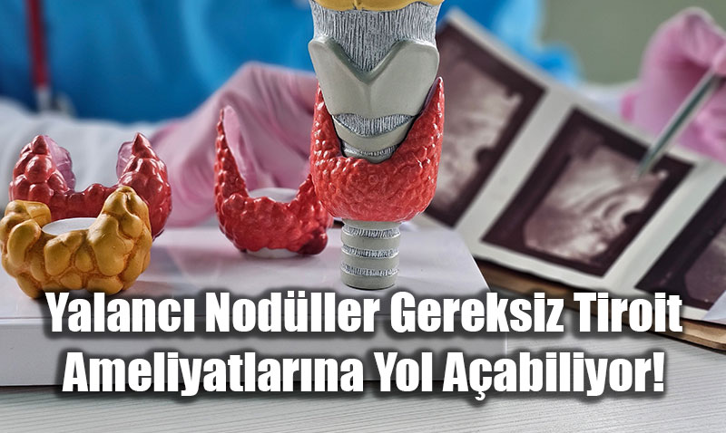 Yalanc Nodller Gereksiz Tiroit Ameliyatlarna Yol Aabiliyor!