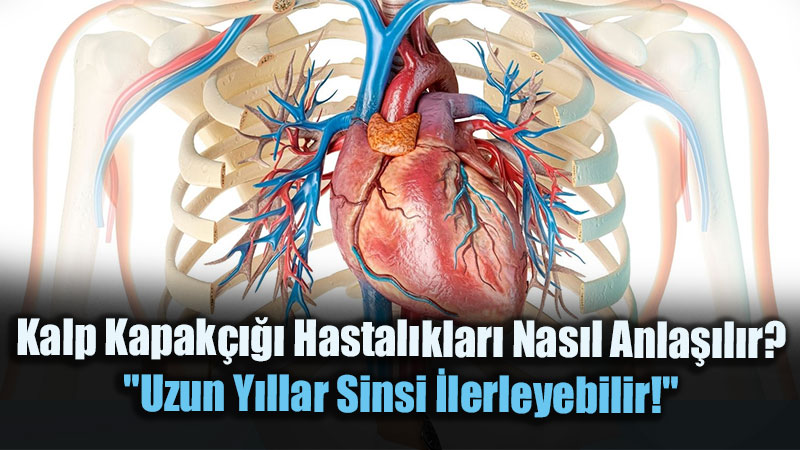 Kalp Kapak���� Hastal�klar� Nas�l Anla��l�r?