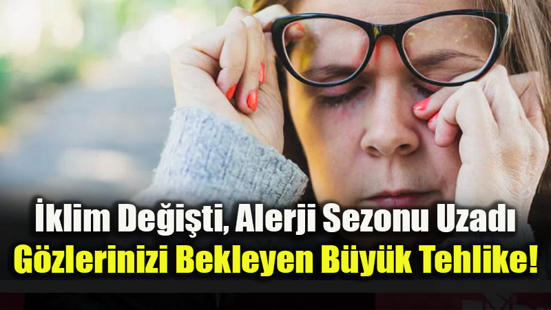 G�z Alerjisini Hafife Almay�n: "�ayla Pansuman" G�rmenizi Karartabilir!